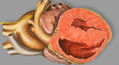 Congenital Heart Defect