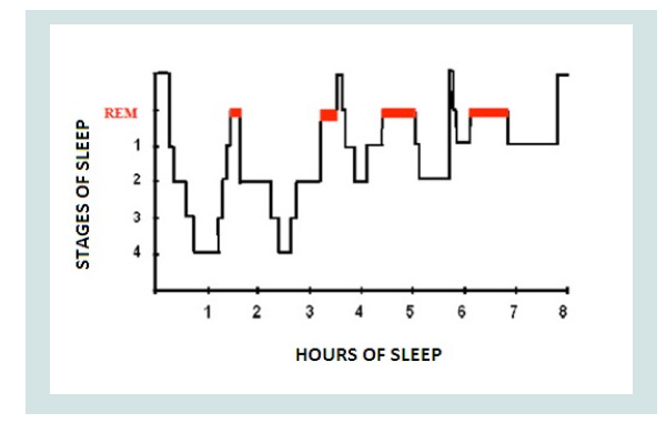 Avens Publishing Group Sleep Wake Disorders Definition Contexts And Avens Publishing Group Sleep Wake Disorders Definition Contexts And