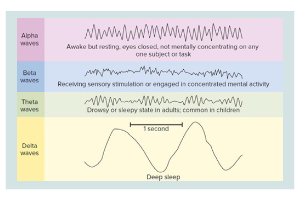 Avens Publishing Group - Sleep-Wake Disorders: Definition, Contexts and ...